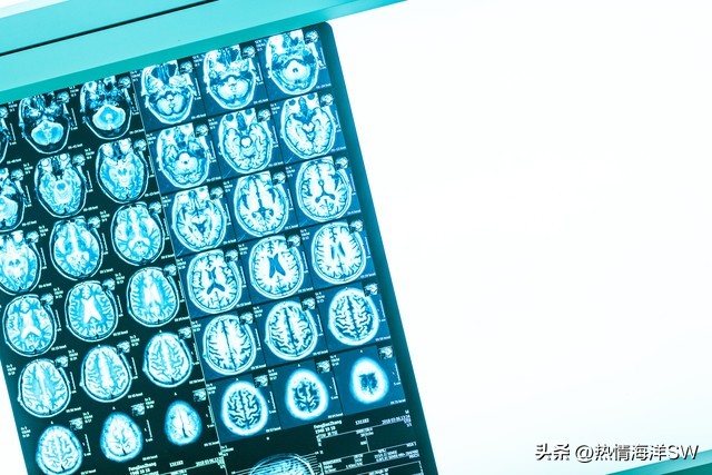 查体体征辅助检查区别_头晕与头昏症状鉴别_神经系统查体学习图片